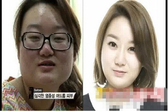 韓国で整形手術を受けた女性の悲惨な現実ｗ