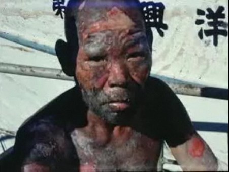 李承晩ラインで半島に強制連行され顔を焼かれた日本人漁民。